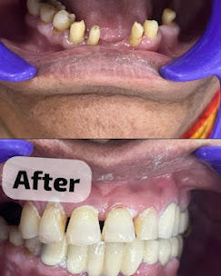 Clinical Case